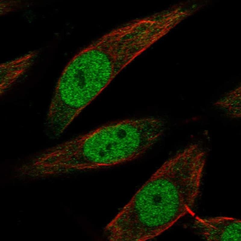 Bag-1 Antibody Immunocytochemistry/Immunofluorescence: Bag-1 Antibody [NBP3-25295]