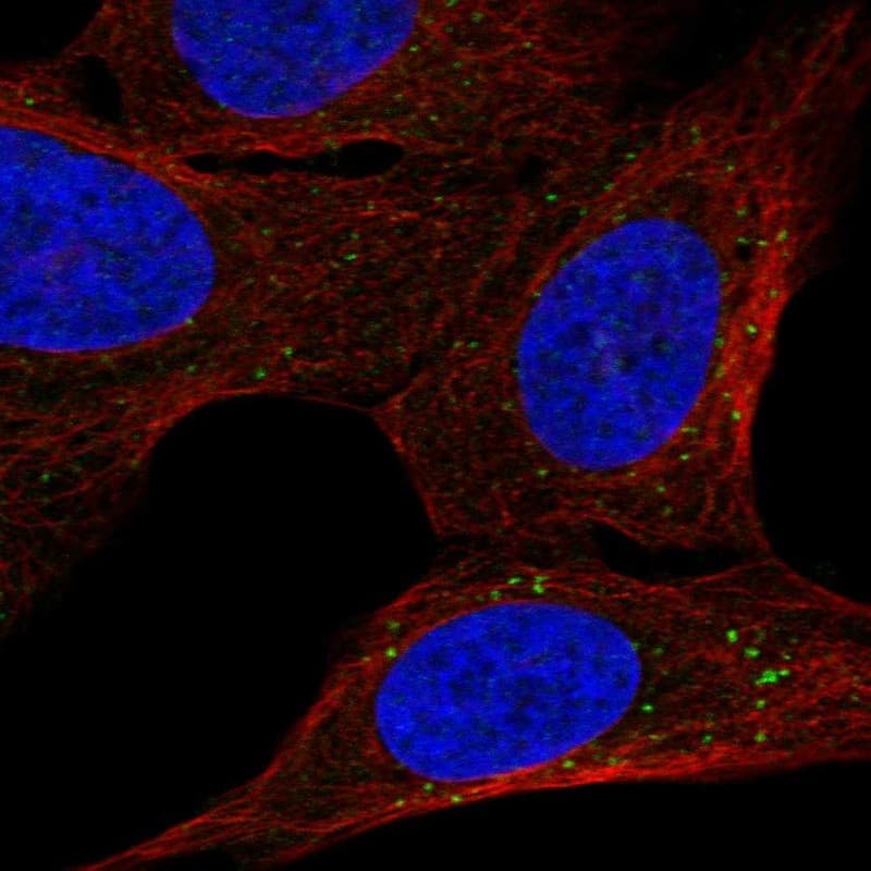 BBS2 Antibody Immunocytochemistry/Immunofluorescence: BBS2 Antibody [NBP3-25296]