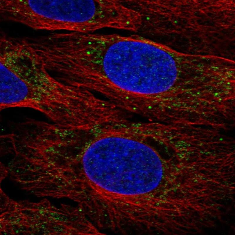 BBS2 Antibody Immunocytochemistry/Immunofluorescence: BBS2 Antibody [NBP3-25297]