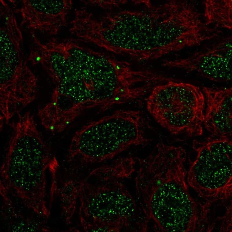 BMP-7 Antibody Immunocytochemistry/Immunofluorescence: BMP-7 Antibody [NBP3-25298]