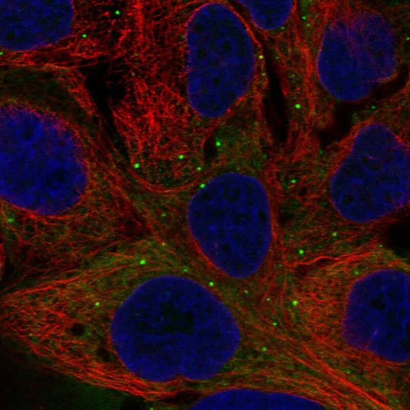 NPPB Antibody Immunocytochemistry/Immunofluorescence: NPPB Antibody [NBP3-25300]