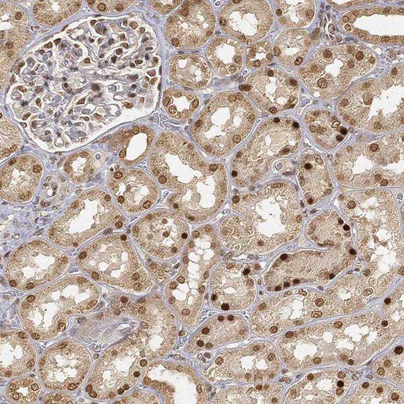 CIB1 Antibody Immunohistochemistry-Paraffin: CIB1 Antibody [NBP3-25301]