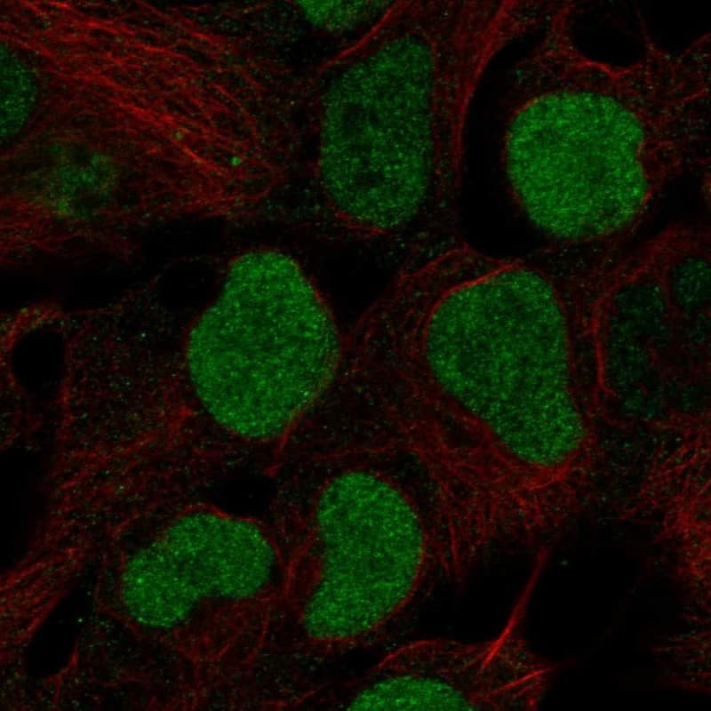 BRD2 Antibody Immunocytochemistry/Immunofluorescence: BRD2 Antibody [NBP3-25302]