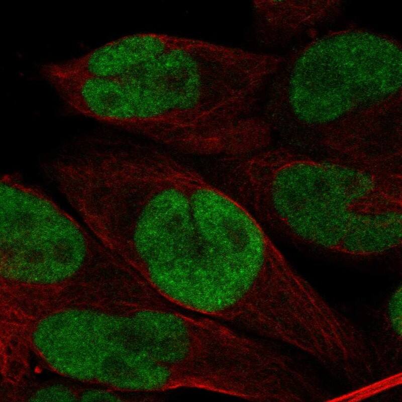 BRD3 Antibody Immunocytochemistry/Immunofluorescence: BRD3 Antibody [NBP3-25303]