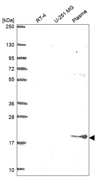 BST2 Antibody Western Blot: BST2 Antibody [NBP3-25305]