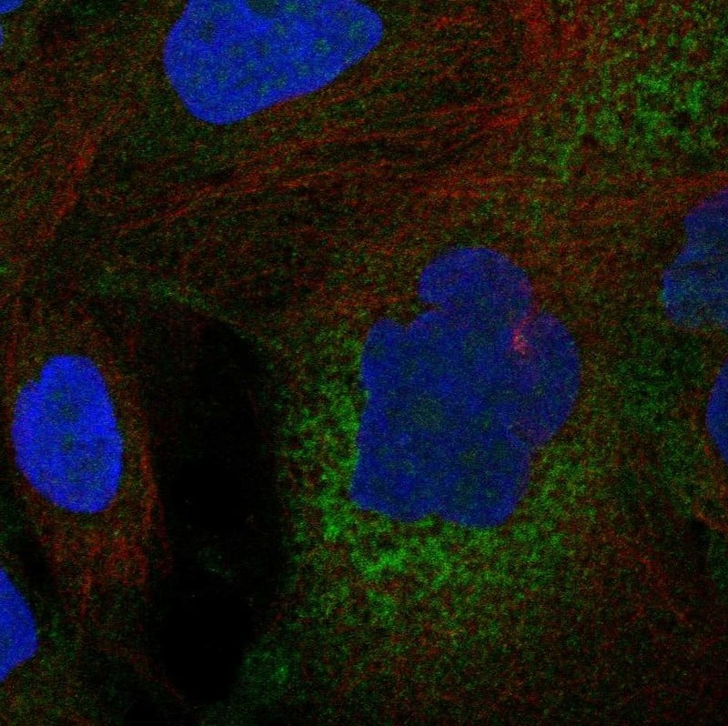 C11orf16 Antibody Immunocytochemistry/Immunofluorescence: C11orf16 Antibody [NBP3-25306]