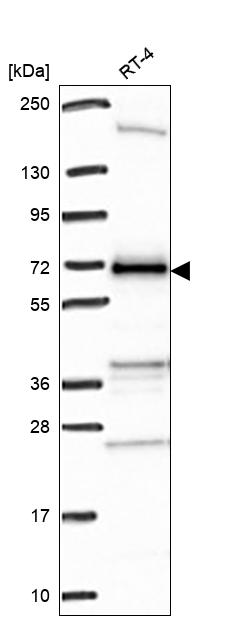 C17orf80 Antibody Western Blot: C17orf80 Antibody [NBP3-25309]