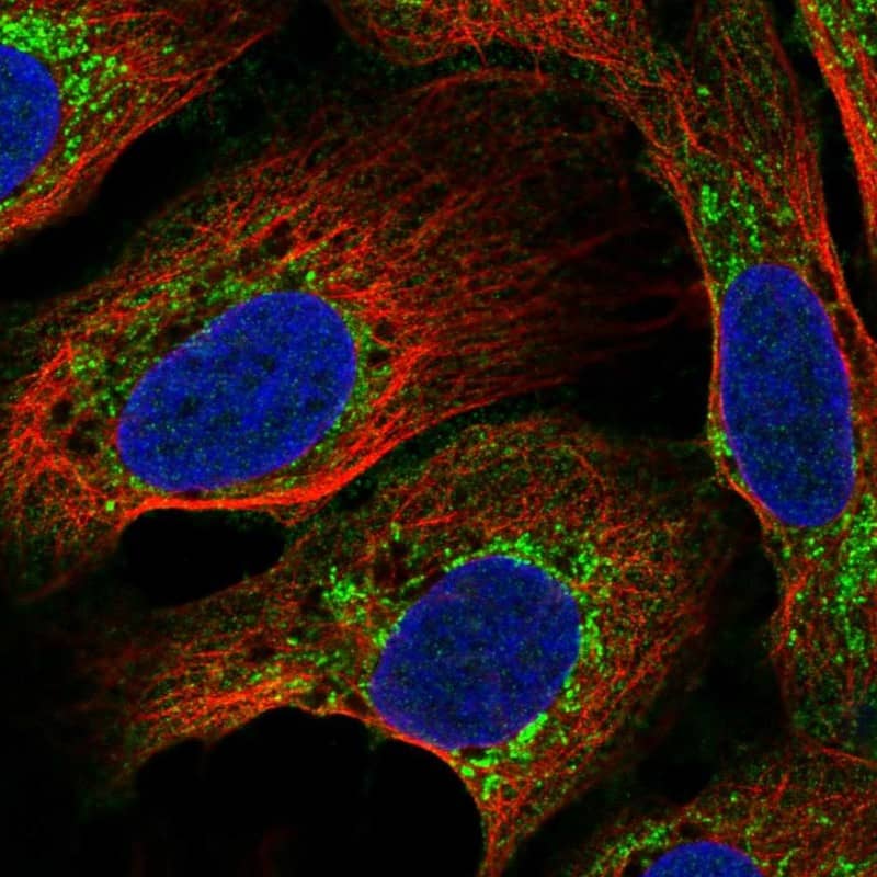 C17orf80 Antibody Immunocytochemistry/Immunofluorescence: C17orf80 Antibody [NBP3-25309]