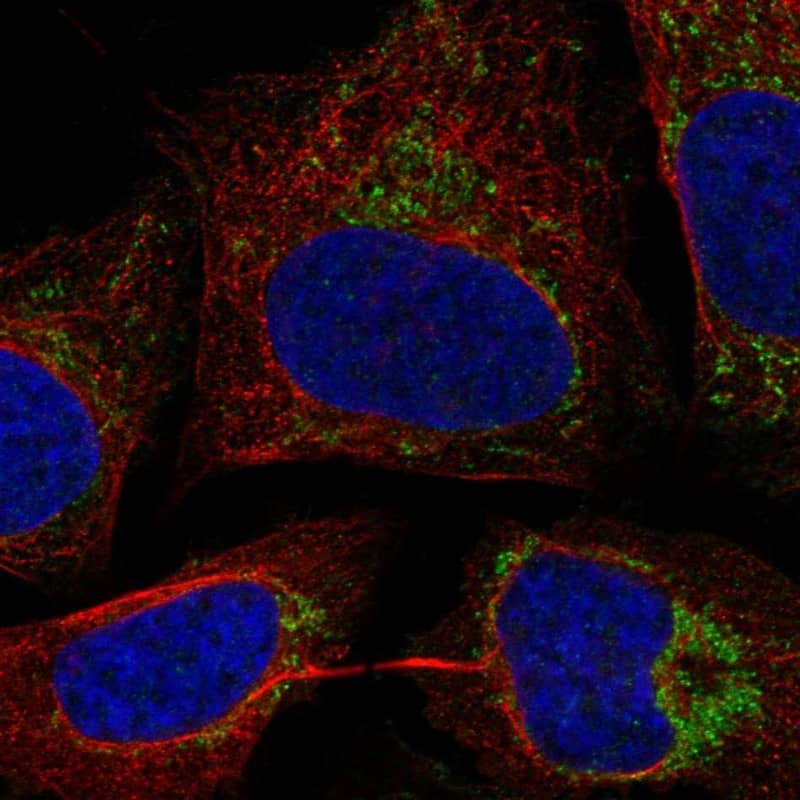 C17orf80 Antibody Immunocytochemistry/Immunofluorescence: C17orf80 Antibody [NBP3-25310]