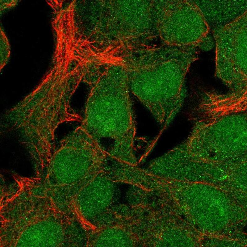 C19orf67 Antibody Immunocytochemistry/Immunofluorescence: C19orf67 Antibody [NBP3-25311]