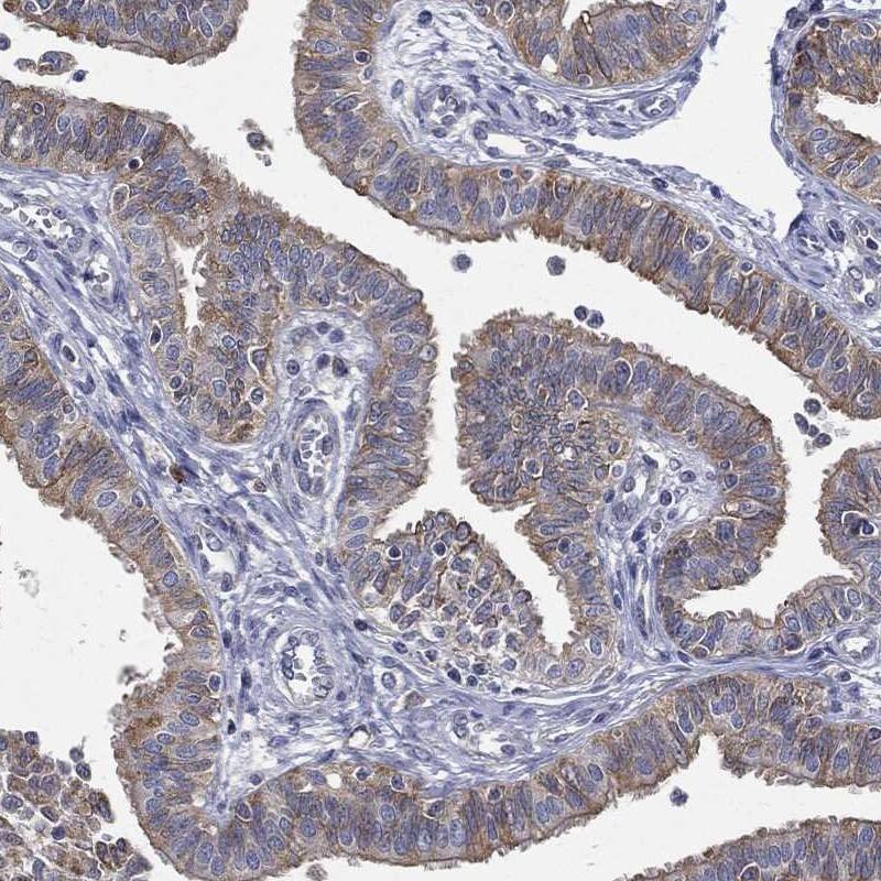 C20orf96 Antibody Immunohistochemistry-Paraffin: C20orf96 Antibody [NBP3-25317]