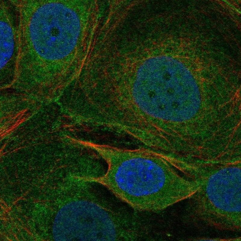 CACNA1I Antibody Immunocytochemistry/Immunofluorescence: CACNA1I Antibody [NBP3-25321]