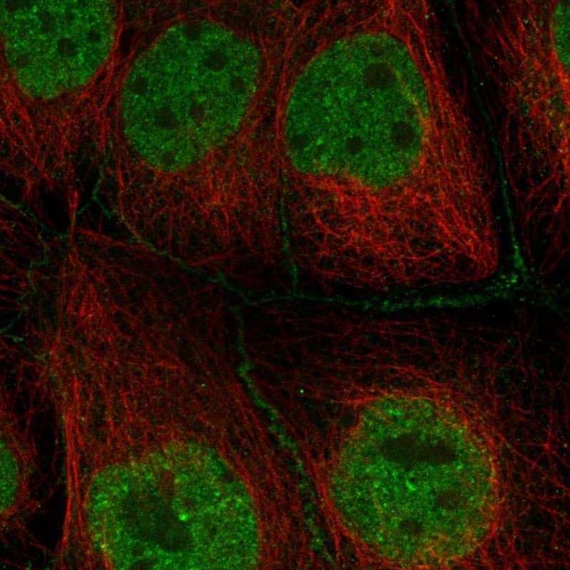 CCDC79 Antibody Immunocytochemistry/Immunofluorescence: CCDC79 Antibody [NBP3-25322]