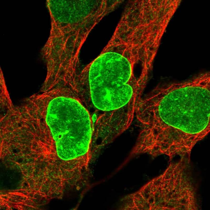 CENPF Antibody Immunocytochemistry/Immunofluorescence: CENPF Antibody [NBP3-25323]