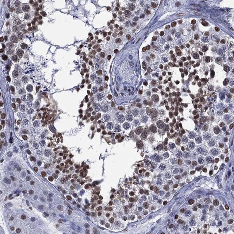 FAM134A Antibody Immunohistochemistry-Paraffin: FAM134A Antibody [NBP3-25324]