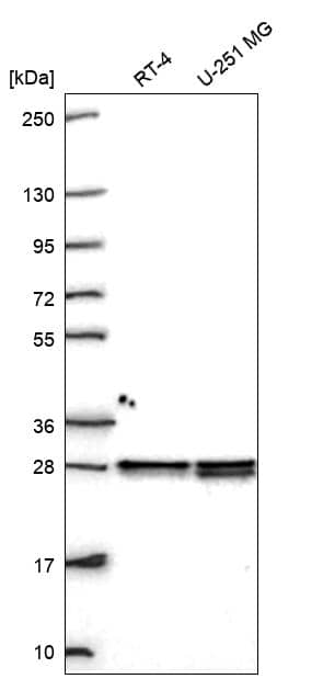 HMGB1/HMG-1 Antibody Western Blot: HMGB1/HMG-1 Antibody [NBP3-25326]