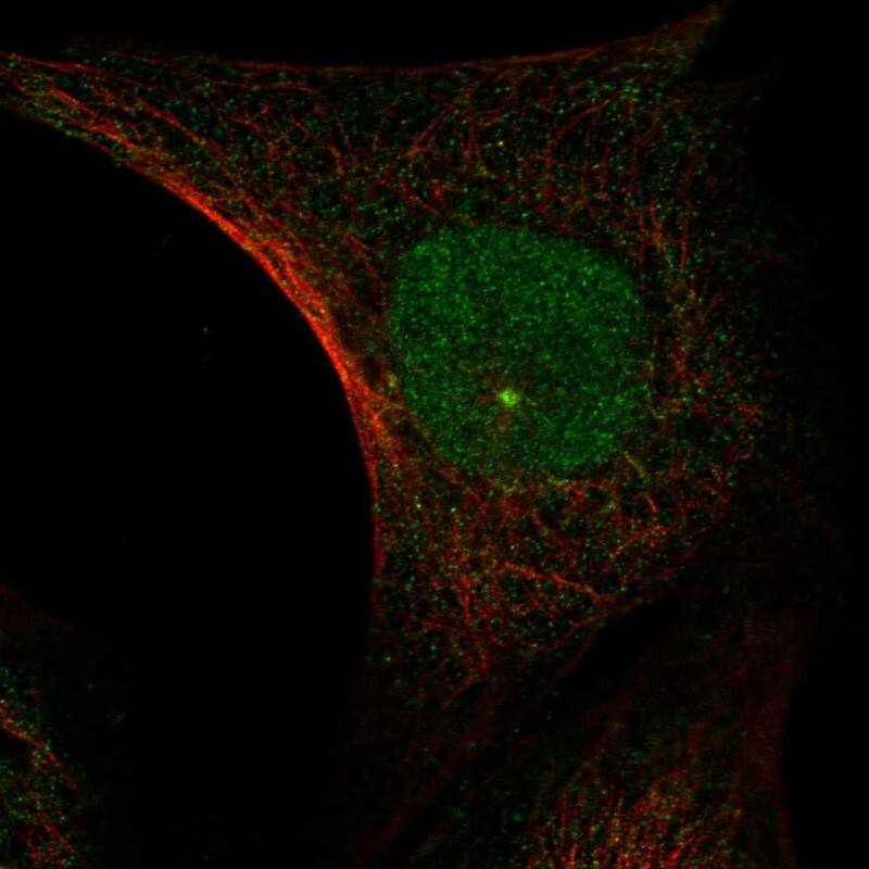 Jade-1/PHF17 Antibody Immunocytochemistry/Immunofluorescence: Jade-1/PHF17 Antibody [NBP3-25327]