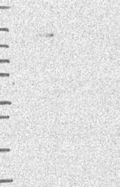 Jade-1/PHF17 Antibody Western Blot: Jade-1/PHF17 Antibody [NBP3-25327]