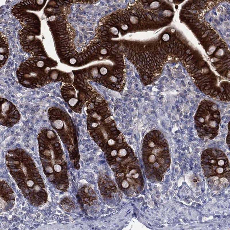 Carboxylesterase 2/CES2 Antibody Immunohistochemistry-Paraffin: Carboxylesterase 2/CES2 Antibody [NBP3-25334]