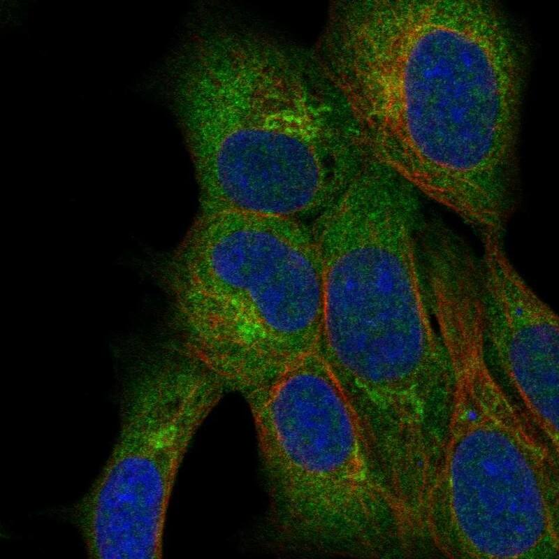 QTRTD1 Antibody Immunocytochemistry/Immunofluorescence: QTRTD1 Antibody [NBP3-25335]