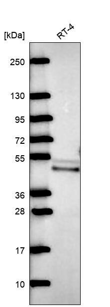 QTRTD1 Antibody Western Blot: QTRTD1 Antibody [NBP3-25335]