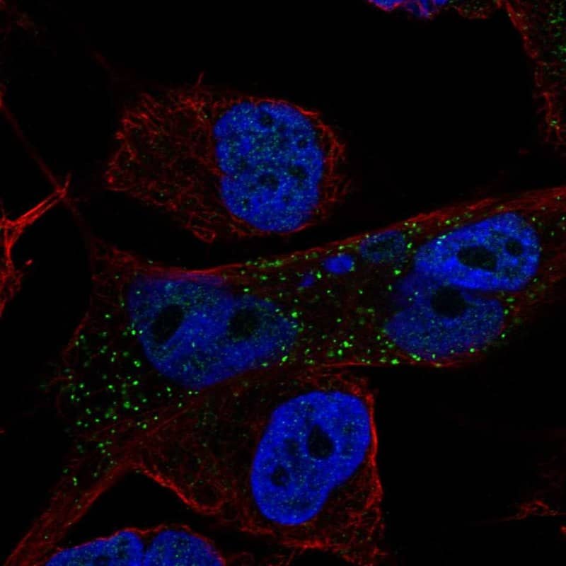 CARD12 Antibody Immunocytochemistry/Immunofluorescence: CARD12 Antibody [NBP3-25336]