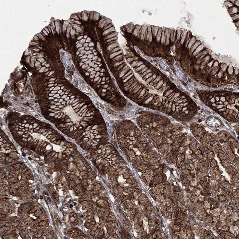 CARD6 Antibody Immunohistochemistry-Paraffin: CARD6 Antibody [NBP3-25337]