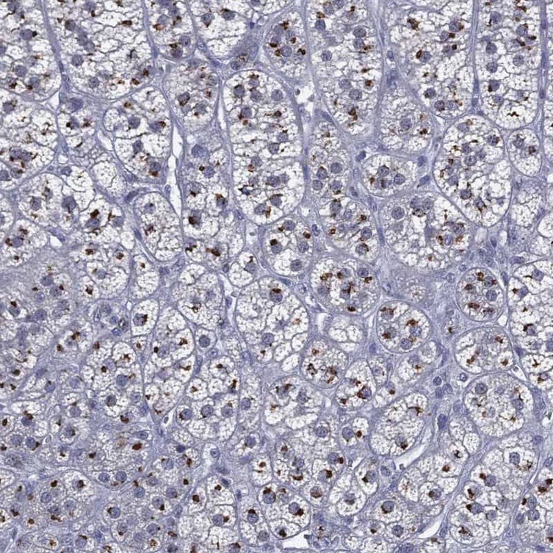 CASD1 Antibody Immunohistochemistry-Paraffin: CASD1 Antibody [NBP3-25339]