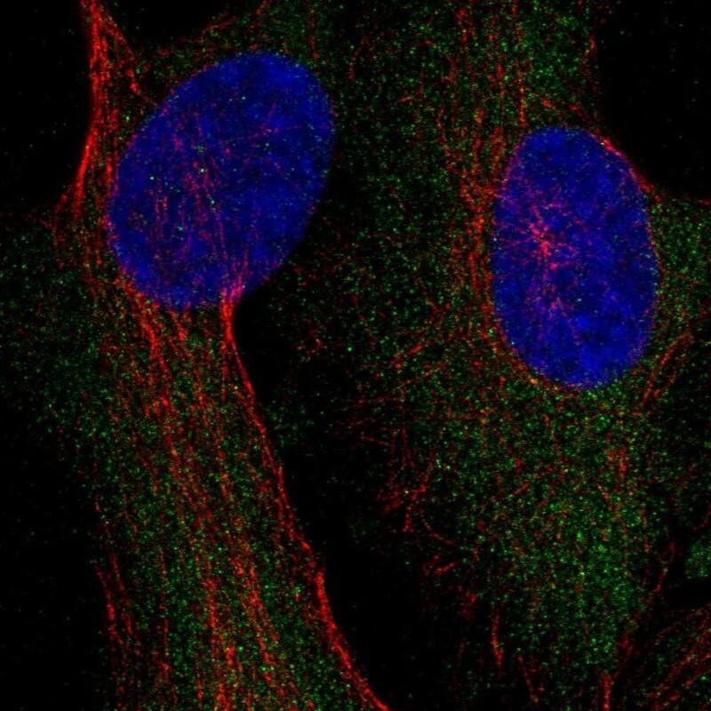 CAD Antibody Immunocytochemistry/Immunofluorescence: CAD Antibody [NBP3-25340]