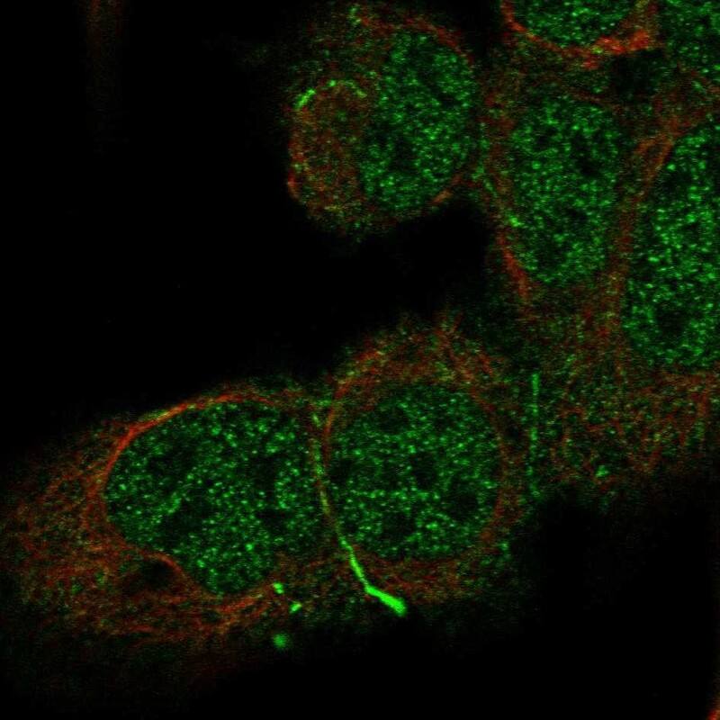 Cadherin-10 Antibody Immunocytochemistry/Immunofluorescence: Cadherin-10 Antibody [NBP3-25341]