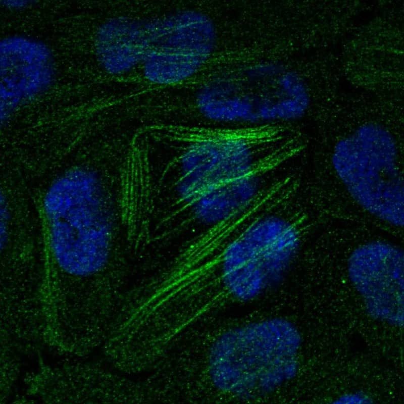 Calponin 2 Antibody Immunocytochemistry/Immunofluorescence: Calponin 2 Antibody [NBP3-25343]