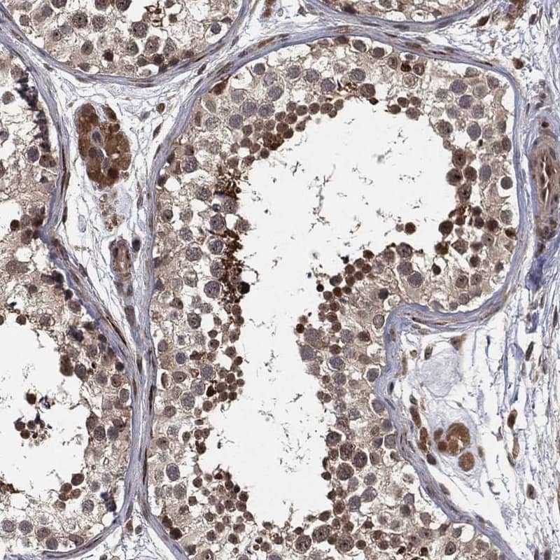 CAPRIN2 Antibody Immunohistochemistry-Paraffin: CAPRIN2 Antibody [NBP3-25344]