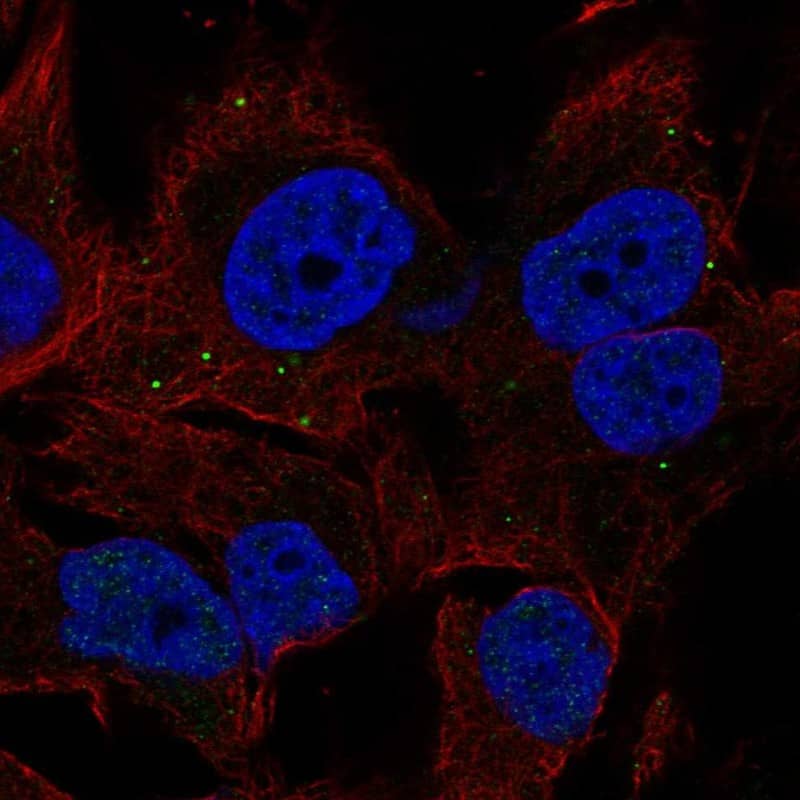 BORCS7 Antibody Immunocytochemistry/Immunofluorescence: BORCS7 Antibody [NBP3-25345]