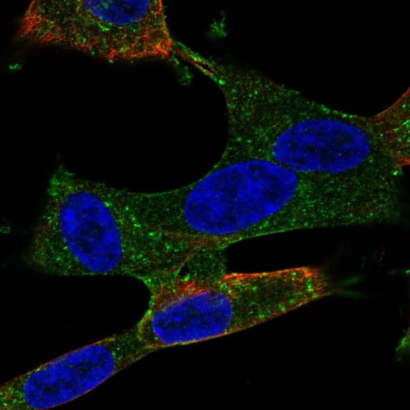 TEM5/GPR124 Antibody Immunocytochemistry/Immunofluorescence: TEM5/GPR124 Antibody [NBP3-25346]