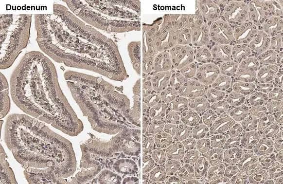 Perilipin-2/ADFP Antibody (HL2147) - Azide and BSA Free