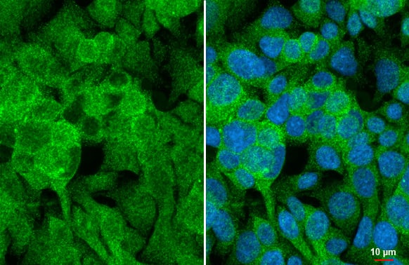 Angiogenin Antibody (HL2214) - Azide and BSA Free