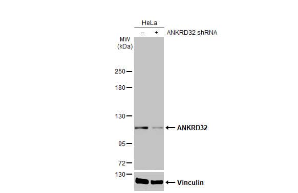 ANKRD32 Antibody (HL2311) - Azide and BSA Free