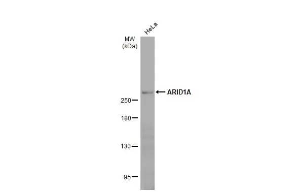 ARID1A Antibody (HL2304) - Azide and BSA Free