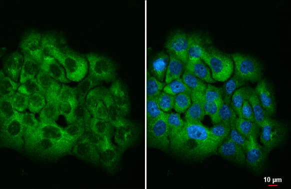 Ataxin-2 Antibody (HL1902) - Azide and BSA Free