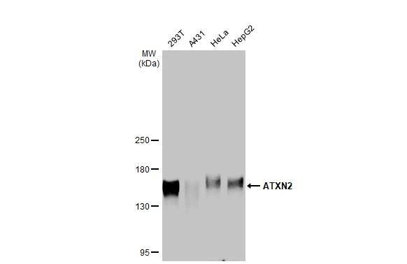 Ataxin-2 Antibody (HL1902) - Azide and BSA Free