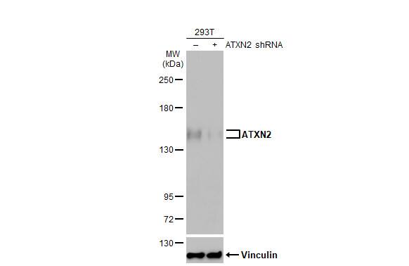 Ataxin-2 Antibody (HL1903) - Azide and BSA Free