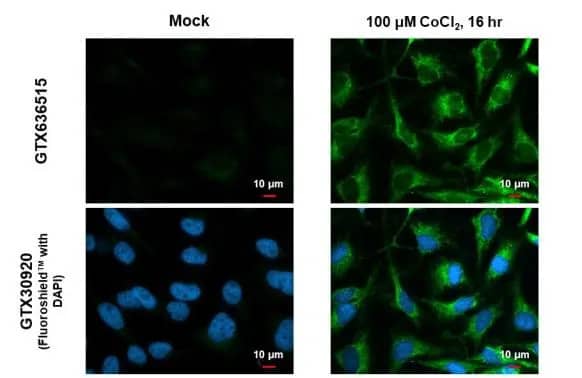 BNIP3L Antibody (HL1203) - Azide and BSA Free