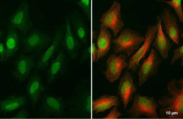 BRD9 Antibody (HL1282) - Azide and BSA Free