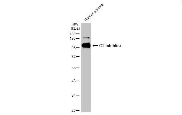 Serpin G1/C1 Inhibitor Antibody (HL1196) - Azide and BSA Free