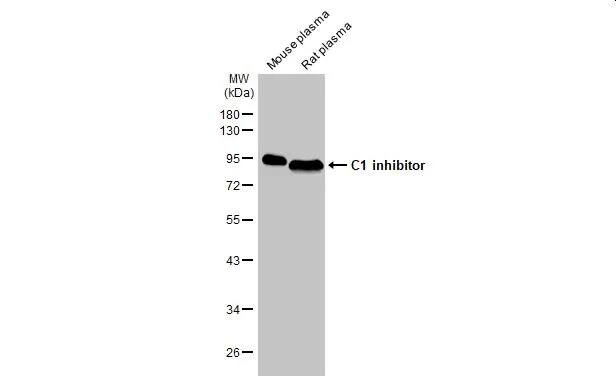Serpin G1/C1 Inhibitor Antibody (HL1196) - Azide and BSA Free