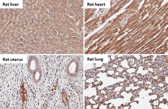 Serpin G1/C1 Inhibitor Antibody (HL1196) - Azide and BSA Free