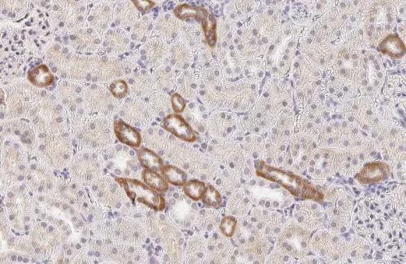 Calcium-sensing R/CaSR Antibody (HL2357) - Azide and BSA Free