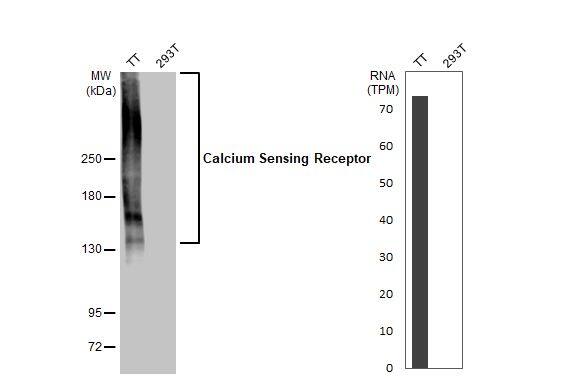 Calcium-sensing R/CaSR Antibody (HL2357) - Azide and BSA Free