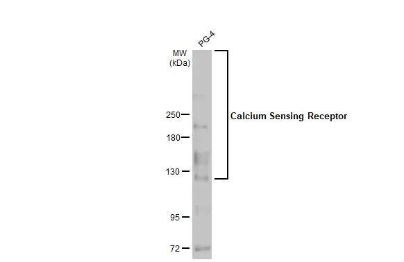 Calcium-sensing R/CaSR Antibody (HL2357) - Azide and BSA Free