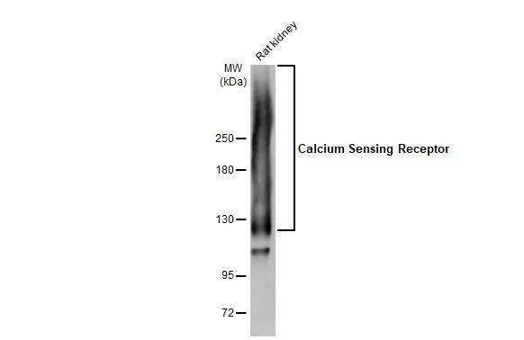 Calcium-sensing R/CaSR Antibody (HL2357) - Azide and BSA Free